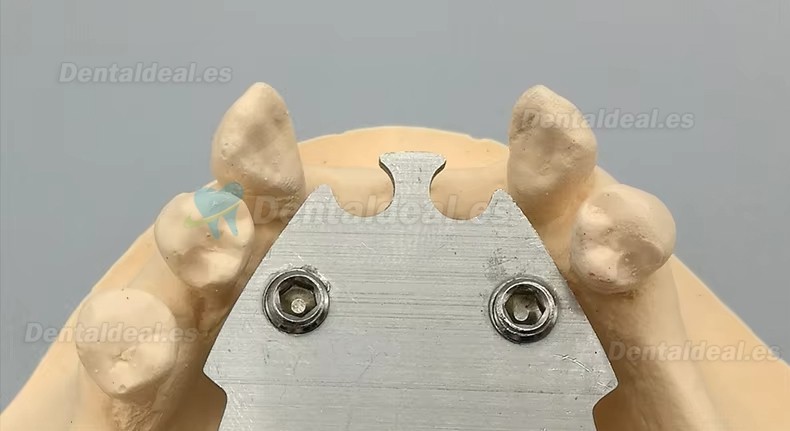 Registrador Relaci&oacute;n C&eacute;ntrica con Trazador Arco G&oacute;tico para Ed&eacute;ntulos